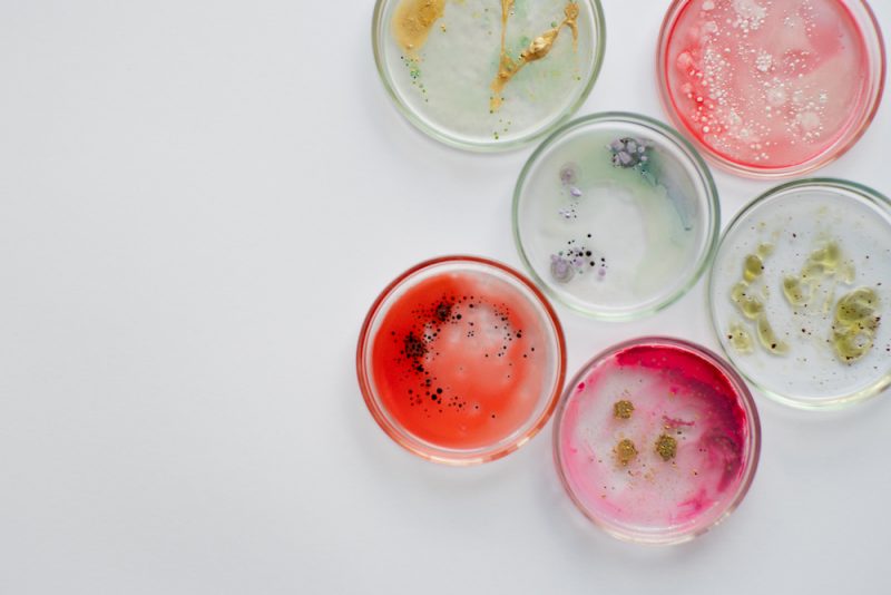 Scientists use petri dishes like these to grow microbes. Photo by Ulia Koltyrina/Adobe Stock.